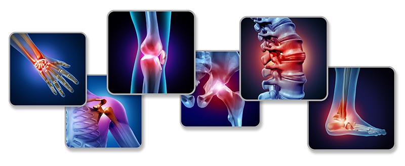 i più frequenti – dolori alle articolazioni delle ginocchia